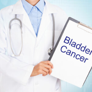 6 early warning signs of bladder cancer